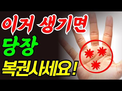 손바닥에 갑자기 '별(★)'이 보이면, 당장 로또 사세요. (100% 횡재수)
