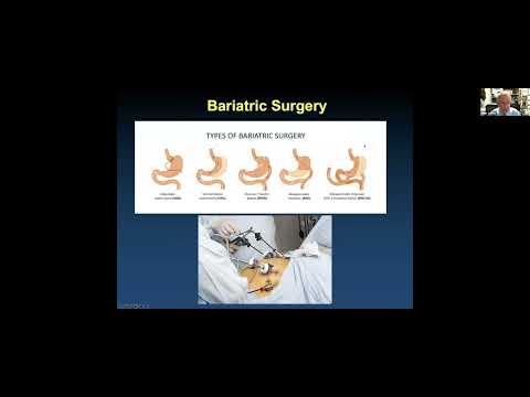 Strategies for Management of Atrial Fibrillation: State of the Art in 2023