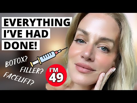 Everything I've Done to my Face: Botox? Filler? Plastic Surgery?