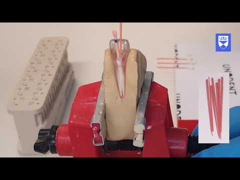 Endodontic treatment of the single rooted tooth. Part 6: Obturation