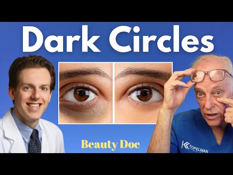 Best Treatments for Dark Circles Under Eyes