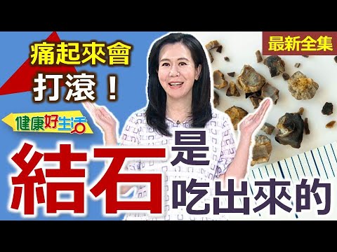 健康好生活  20251112  痛起來會打滾？「結石」是吃出來的？