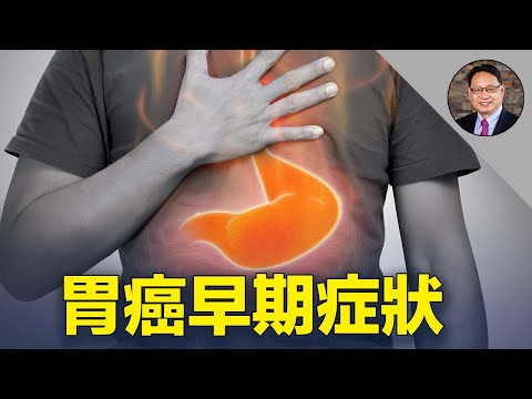胃癌有哪些早期症狀？預防胃癌的6大關鍵點是什麼？