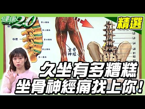 久坐有多糟糕「#坐骨神經痛」找上你!屁股練好走到老!【健康2.0精選】