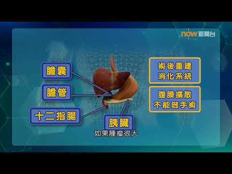 20250416【杏林在線】胰臟癌與糖尿病