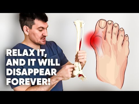 Relax this muscle and your bunion will disappear for good! Give it a try!