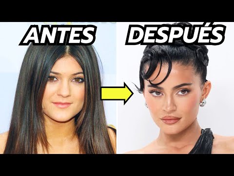 15 Celebrities Obsessed With Plastic Surgery - INCREDIBLE