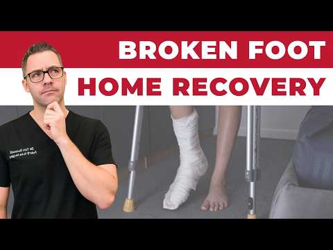 Broken Foot Recovery & Foot Fracture Home Treatments [Top 25 Hacks]