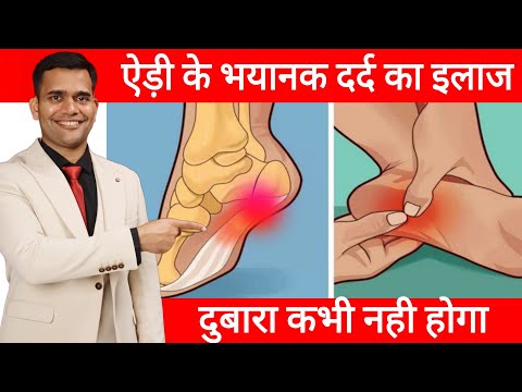 ऐड़ी के दर्द का 100% इलाज | Heel Pain Treatment at home - Dr. Vivek Joshi