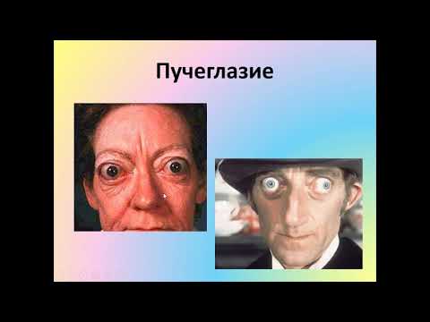 Лекция Патофизиология  эндокринной системы на рус яз