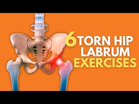 Top 6 Exercises For Naturally Healing A Painful Torn Hip Labrum