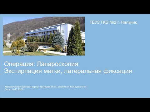 Экстирпация матки латеральная фиксация