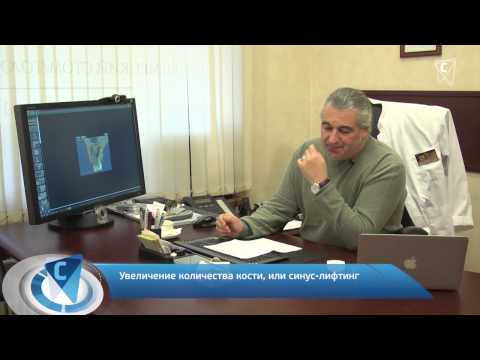 Что такое открытый синус-лифтинг?