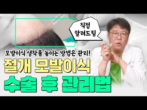 절개 모발이식 수술 후 관리법