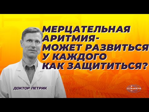 Мерцательная аритмия может развиться у каждого. Как защититься от тяжелых последствий.