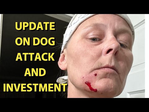 UPDATE ON DOG ATTACK AND INVESTMENT