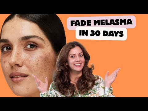 How to Fade Melasma in 30 Days at Home | Affordable Skincare Routine That Works | Nipun Kapur