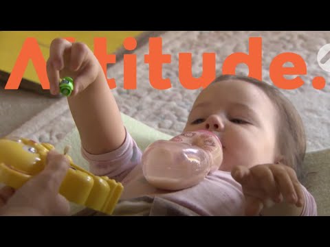 An Unusual Condition: Arthrogryposis