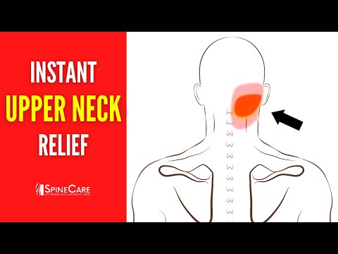 How to Fix Upper Neck Pain FOR GOOD