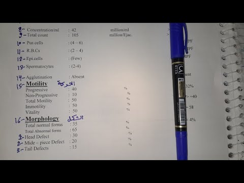 قراءة تحليل السائل المنوي(Semen analysis)