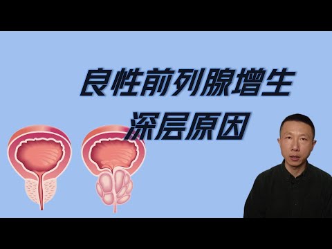 Two Deep-Rooted Causes of Benign Prostatic Hyperplasia (Hormonal Imbalance and Chronic Inflammation)