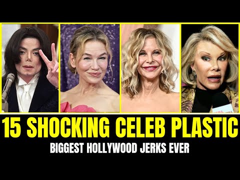 15 Shocking Celebrity Plastic Surgery Disasters | Before and After