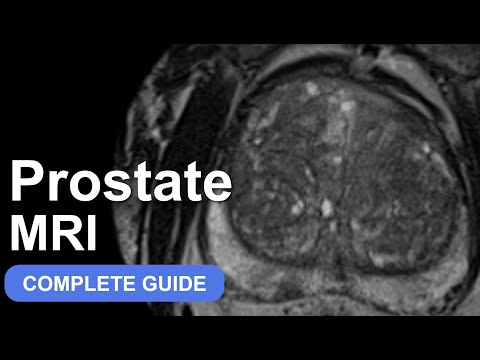 Introduction to Prostate MRI and PI-RADS: Approach and Principles
