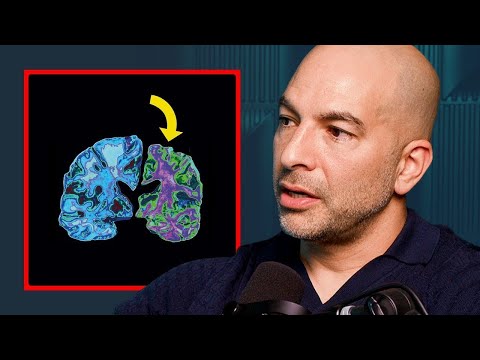 How to Save Your Brain From Cognitive Decline - Dr Peter Attia