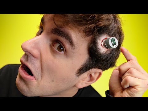 La verità sui CHIP NEL CERVELLO