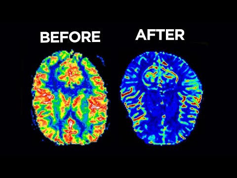 When The Doctor Accidentally Injects Formaldehyde