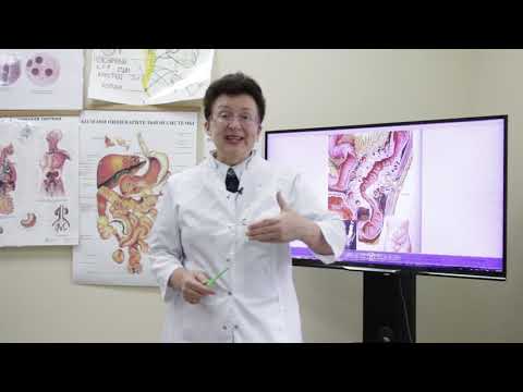 КАК ИЗБАВИТЬСЯ ОТ ЗАПОРА