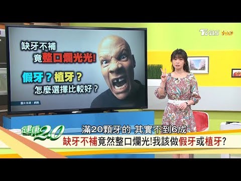 缺牙不補竟整口爛光，該做假牙或植牙？油漱口三招讓你牙齒好！健康2.0 20190323(完整版)