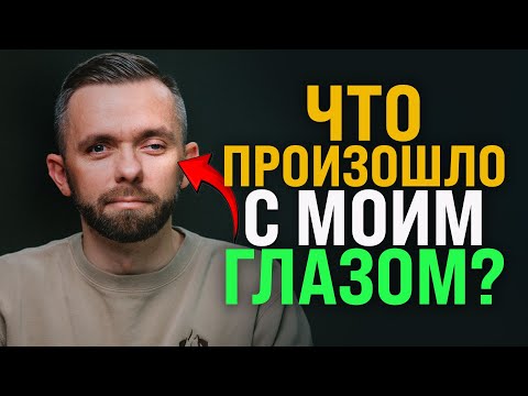 Что произошло с моим глазом?