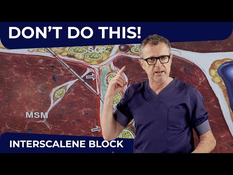 INTERSCALENE BLOCK: DON'T DO THIS!