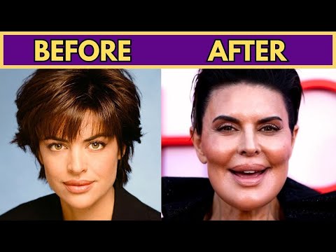BEFORE & AFTER PLASTIC SURGERY — CELEBRITIES WHO LOOK TOTALLY DIFFERENT