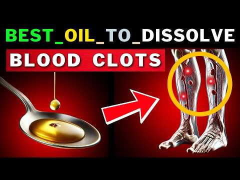 Melt Blood Clots Naturally: Top 6 Powerful Oils