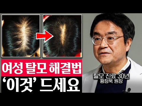 "30년 탈모 환자 치료하고 알아냈다." 빠지는 머리 숱 풍성해지는 법 (황정욱 원장 2부)