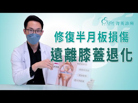 修復半月板損傷 遠離膝蓋退化｜尤稚凱醫師