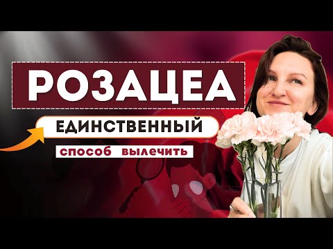 Розацеа: единственный способ сделать кожу здоровой навсегда (открытая лекция, комплексный подход)