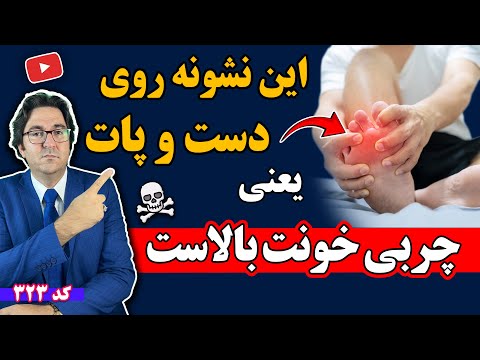 چربی خون بالا با این نشونه‌ها خودش رو لو می‌ده ! حتماً ببین قبل از اینکه دیر بشه⚠️