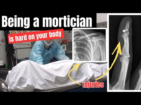 Being a mortician is hard on your body