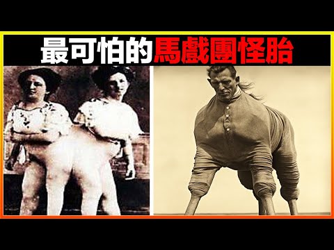 奇怪男子長有兩個生x器？無數女士爭相圍觀。18個最不可思議的馬戲團怪胎，猶如外星人來到地球｜#世界之最top #世界之最 #冷知識 #腦洞大開 #top10  #地球之最 #排名