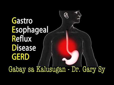 GastroEsophageal Reflux Disease (GERD) - Dr. Gary Sy