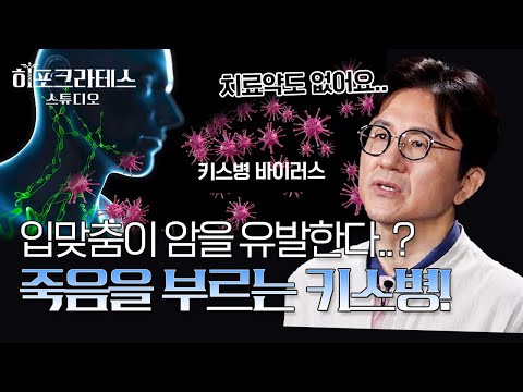 신혼여행 첫날밤 키스 때문에 사망한 신부?! 건강을 위협하는 키스와 건강을 위한 키스까지💋 [서재걸의 면역내과]