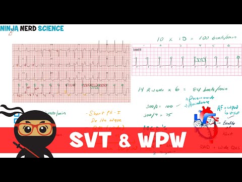 Rate and Rhythm | Supraventricular Tachycardia (SVT) and Wolff-Parkinson-White (WPW) Syndrome