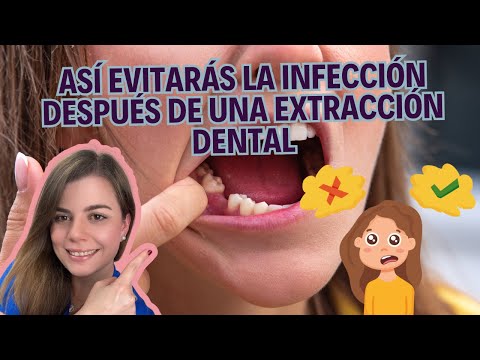 What to do after a tooth extraction in 2024 ✅