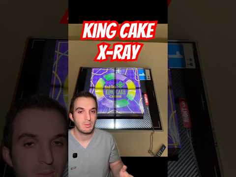 X-ray of a king cake mardi