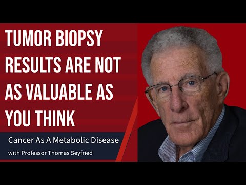 Genetic Mutations Are Not the Origin of Cancer