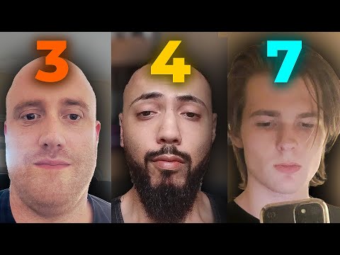 Face Rating + Looksmaxxing Reddit Faces (Brutally Honest)