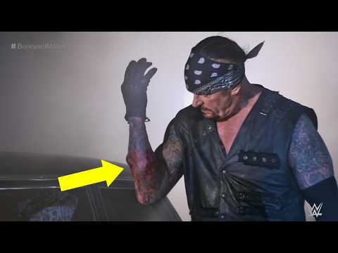 The WORST Botch of Every WWE WrestleMania